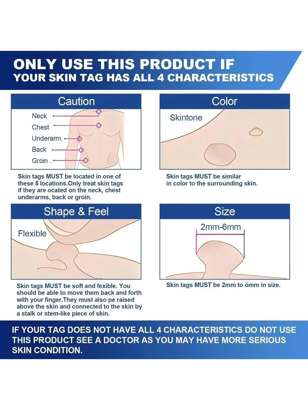 Fast-Acting Skin Tag Remover, Maximum Formula 30ml